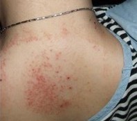 ����ţƤѢ��֢״��ʲô