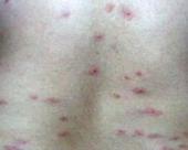 Ƥ���෢��������ݡ����