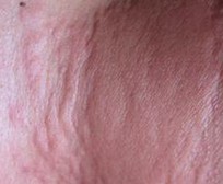 ��������ݡ�����֢״����