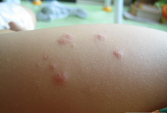 С��ݡ����֢״