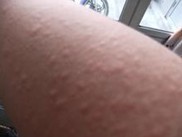 ������ݡ��������Ԥ��