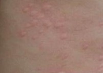 ���ƺ�����ݡ������ѡ�ϲ�Ƥ����ר��ҽԺ