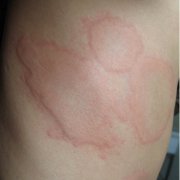 �ϲ��õ�ݡ����ҽԺ