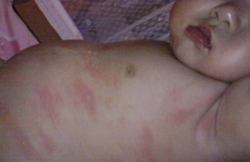 �ϲ�רҵݡ����ҽԺ