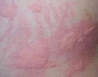 �ϲ�ҽԺݡ������ô����