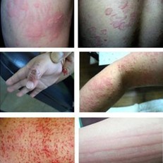 �ϲ�����רҵ����ݡ�����Ƥ����ҽԺ