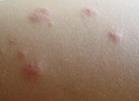 �ϲ�����õ�ݡ����ҽԺ