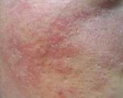 ʲô���չ���ݡ����֢״