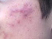 �����ഺ������Ҫע��Щʲô��