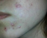 �ഺ����Ԥ����ʩ����Щ��