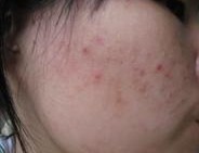 �ഺ��������Ԥ��