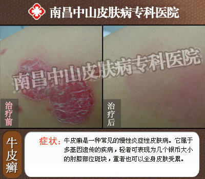 ţƤѢ��������ǰ��Ա�