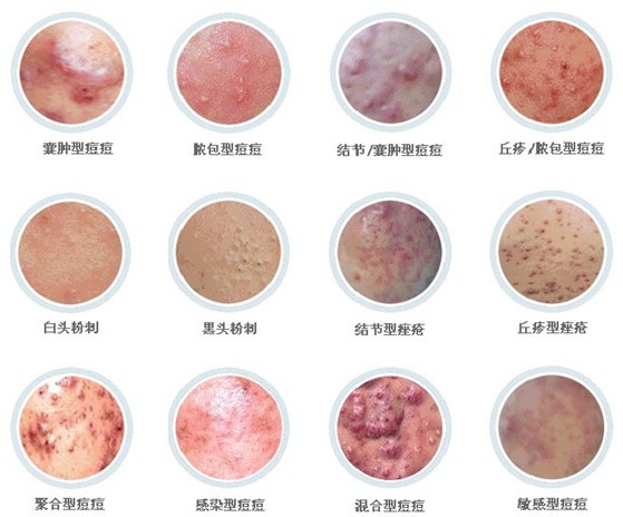 �ഺ����֢״