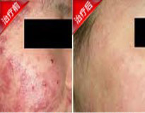 ����ƿ�������