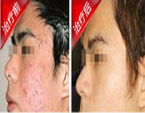 �ഺ�����ƿ�������