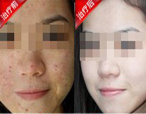 �ഺ����������Ʒ���