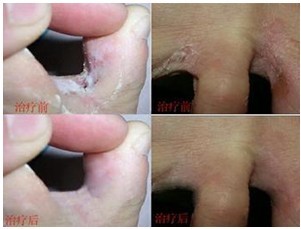 ʪ�����ƿ����Ա�