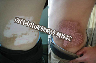 �ϲ���ɽƤ����ҽԺ���翵������