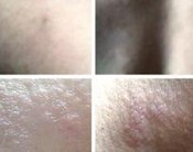 ���۲���֢״����