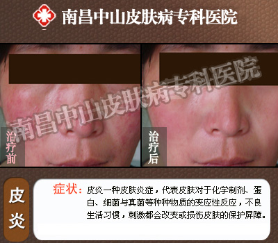 �ϲ���ɽƤ����ҽԺƤ�׿�������