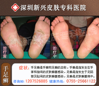 �ϲ���ɽƤ����ҽԺ����Ѣ������������ǰ��