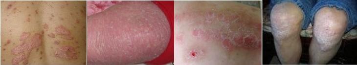 ţƤѢ�ĳ���֢״