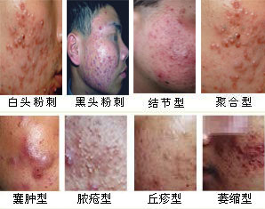 �֢״����