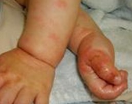 ʪ��ķ���ԭ��