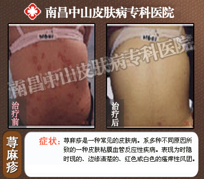 ݡ��������ǰ��Ա�