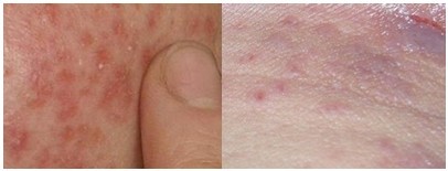 �Ӵ���Ƥ������ǰ��Ա�