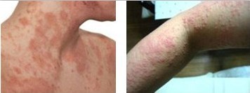 �Ӵ���Ƥ������ǰ��Ա�