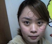 ��ױƷ����֢״