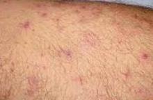 ë��������ô�����