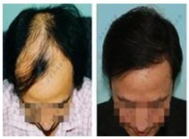 �ѷ�����ǰ��Ա�