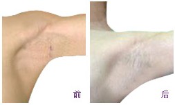 �ϲ���ɽƤ����ҽԺ