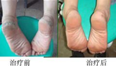 ÄϲýÖÐɽƤ·ô²¡Ò½Ôº