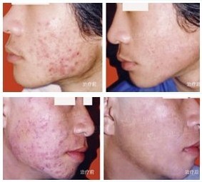 �ϲ���ɽƤ����ҽԺ