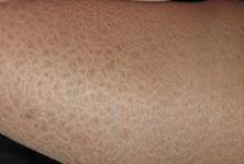 �ϲ���ɽƤ����ҽԺ