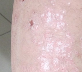 �ϲ���ɽƤ����ҽԺ