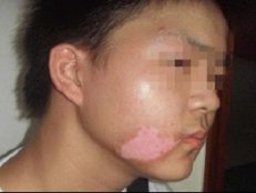 ��ͯ�װ����ȷ���Ƿ���磿