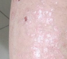 ר�ҽ�����۲�Ϊʲô���Ŵ���