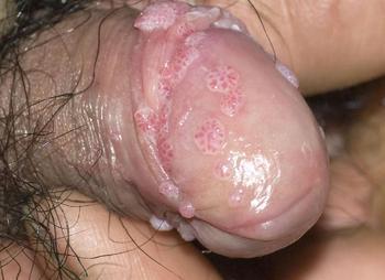 �ϲ���ɽƤ����ר��ҽԺ