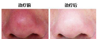 南昌中山皮肤专科也一样