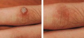 Ѱ�������ƶԱ�