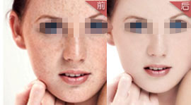 �ϲ���ɽƤ����ҽԺ