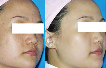 �ϲ���ɽƤ����ҽԺ