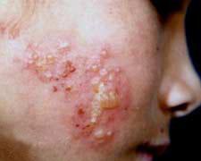 ��״�����֢״