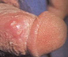 ��ֳ��������ʲô���Σ��