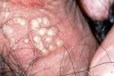 ��ɽר�ҽ�������ֳ������֢״����ʲô