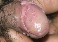 �������ʪ�����������Щ